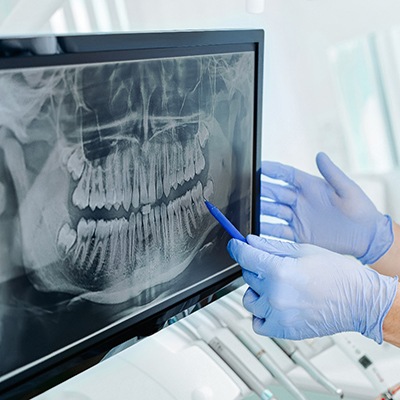 a dentist pointing to an X-ray