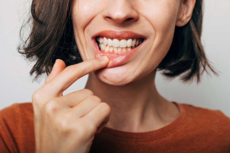 Lady shows her teeth and gums